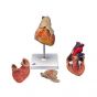 Corazón clásico con timo, de 3 piezas 3B scientific G08/1