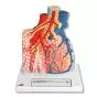 Lobulillos pulmonares y vasos sanguíneos adyacentes G60