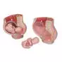 MEDart™ Pelvis durante el embarazo MAL20