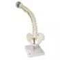 Columna flexible, con discos intervertebrales suaves VB84