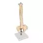 Columna flexible, con discos intervertebrales suaves VB84