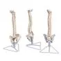 Columna flexible, con discos intervertebrales suaves VB84
