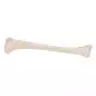 Tibia, izquierda A35/3L