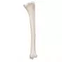 Tibia, izquierda A35/3L