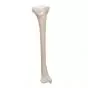 Tibia, izquierda A35/3L