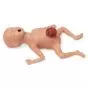 Simulador bebé prematuro Micro-Preemie Life/Form®, piel clara 3B Scientific