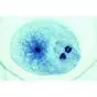 Embriología de la Ascaris megalocephala (Ascaris megalocephala bivalens) 3B Scientific