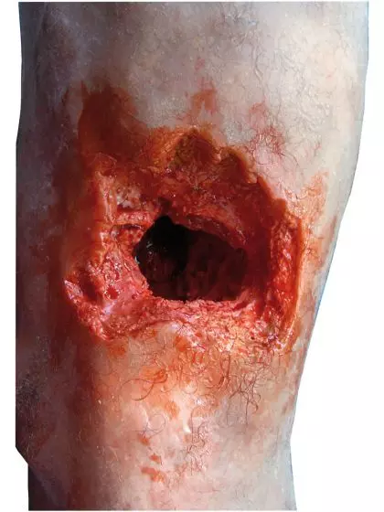 Simulador de pierna herida R50020 de Erler Zimmer