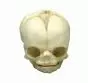 Modelo de cráneo de feto de 21 semanas ½ 4762 Erler Zimmer