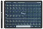 Electrocardiógrafo Spengler Cardiomate EVI (12 canales) con interpretación
