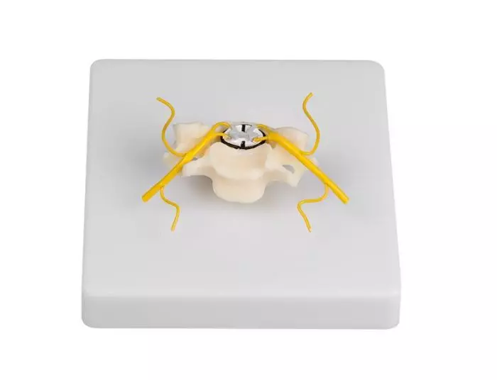 Vértebra cervical con sección de la médula espinal 4067 Erler Zimmer