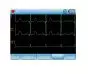 Electrocardiógrafo portátil ECG de 3 canales Contec 90A con interpretación