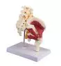 Modelo de cadera con músculos y nervio ciático 4049 Erler Zimmer