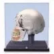 Cráneo de demostración de lujo con vitrina A27/9 3B scientific