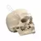 Cráneo Microcefálico 3B scientific A29/1