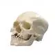 Cráneo con Paladar y Maxilar Hendido 3B - A29/3