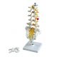 Columna vertebral lumbar con hernia discal dorsolateral 3B scientific A76/5