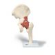 Modelo funcional de la articulación de la cadera de lujo 3B scientific - A81/1