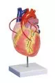 Corazón con bypass coronario aumentado 2 veces G206 Erler Zimmer