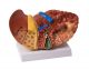 Modelo de hígado enfermo K75 Erler Zimmer