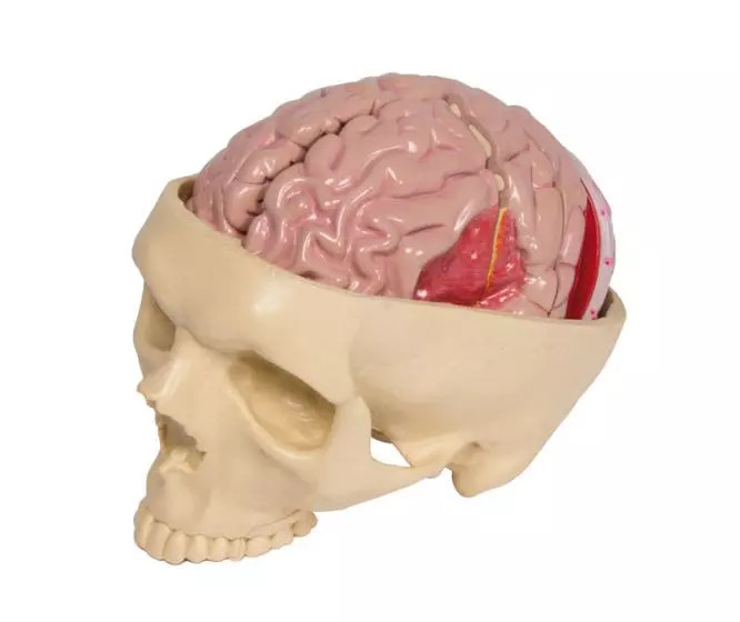 Modelo de cerebro con enfermedades cerebrales Erler Zimmer