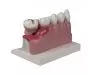 Modelo de dentadura inferior, aumentada 4 veces D250 Erler Zimmer