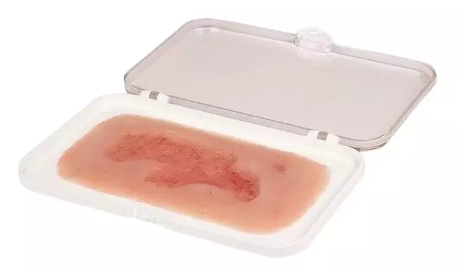 Modelo de una úlcera venosa en la pierna en fase de epitelización