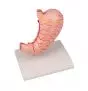 Modelo de estómago en 2 piezas K215 Erler Zimmer
