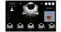 Escáner vesical / Escáner vesical portátil Peaksonic BladderView M4