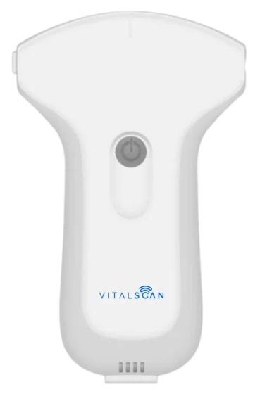 Ecógrafo conectado ultraportátil Vital Scan X3