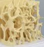 Modelo osteoporosis 4062 Erler Zimmer