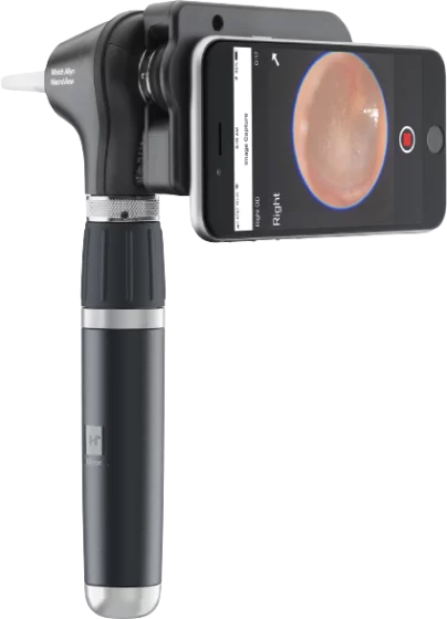 Otoscopio LED MacroView 2 Plus con iExaminer de Welch Allyn