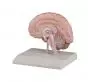 Parte derecha del cerebro humano Erler Zimmer