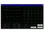 Electrocardiógrafo ECG Contec 600G de 6 canales con interpretación