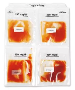 Paquete colesterol y triglicéridos en sangre W44722 3B Scientific