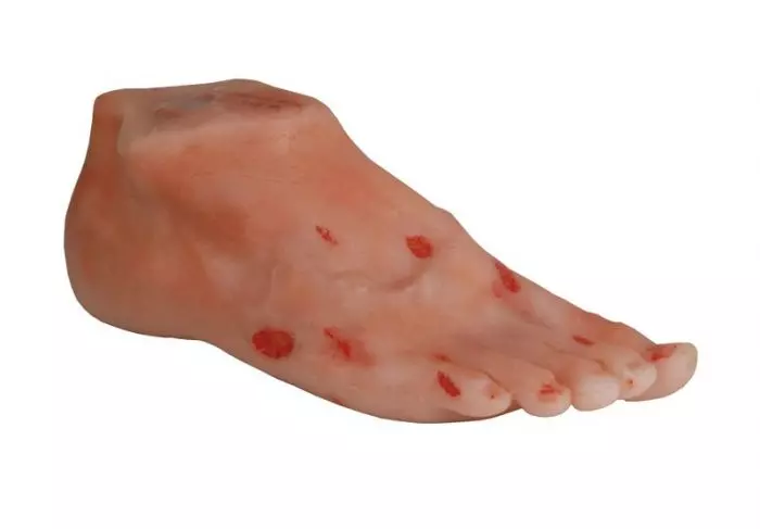 Modelo de pie diabético con úlceras R50067 Erler Zimmer