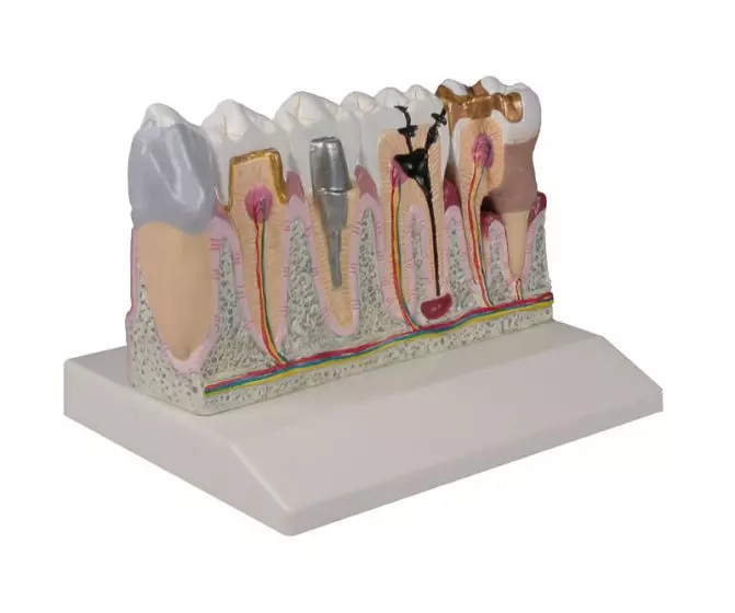 Modelo de dentadura inferior, aumentada 4 veces D250 Erler Zimmer