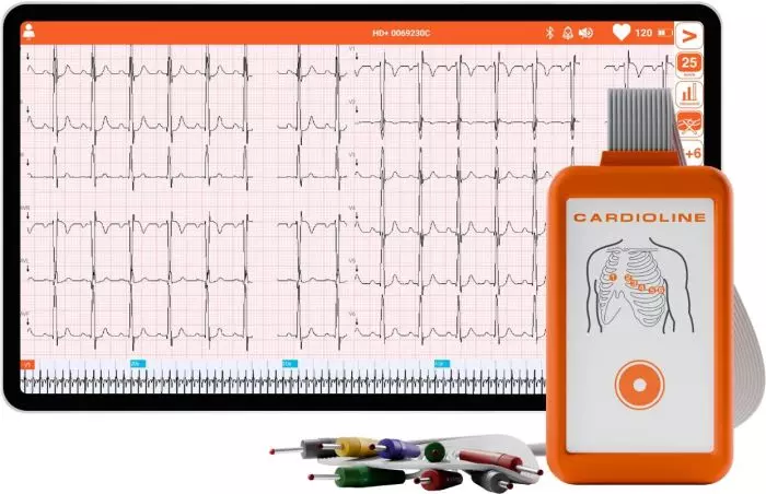 Electrocardiógrafo ECG Cardioline Touchecg HD+ Bluetooth (12 derivaciones) para Android con tableta de 10