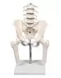 Vértebras lumbares con pelvis y muñones femorales sobre base 4045 Erler Zimmer