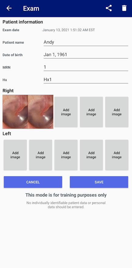 Otoscopio MacroView Plus | Welch Allyn - Foto 11