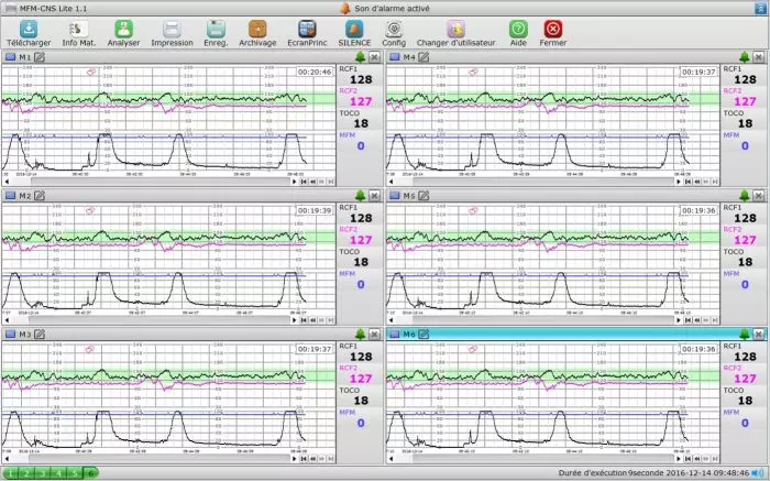 Software para PC MFM-CNS Lite para el cardiotocógrafo Edan F3