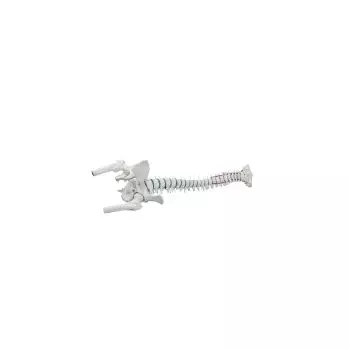 Columna vertebral estándar con prolapso, porciones femorales y pelvis Erler Zimmer 4033-1