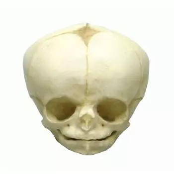 Modelo de cráneo de feto de 34 semanas 4747 Erler Zimmer