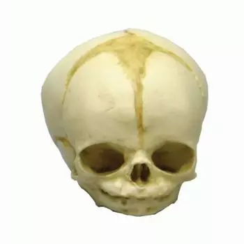 Modelo de cráneo de feto de 32 semanas 4750 Erler Zimmer
