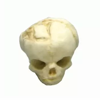 Modelo de cráneo de feto de 17 semanas 4767 Erler Zimmer