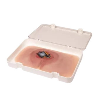 Modelo de úlcera por presión sacra no tratada Erler Zimmer