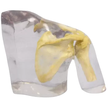 Fantasma radiográfico de hombro Erler Zimmer