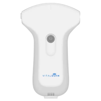 Ecógrafo conectado ultraportátil Vital Scan X3