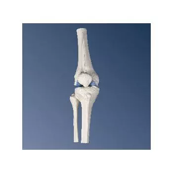 Mini-articulación de la rodilla, sin base A85