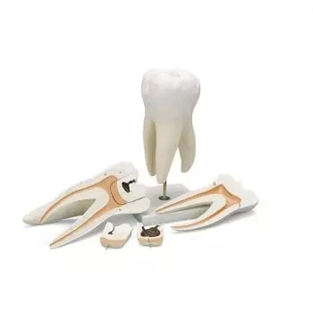 Modelo de molar superior con caries D15 3B Scientific